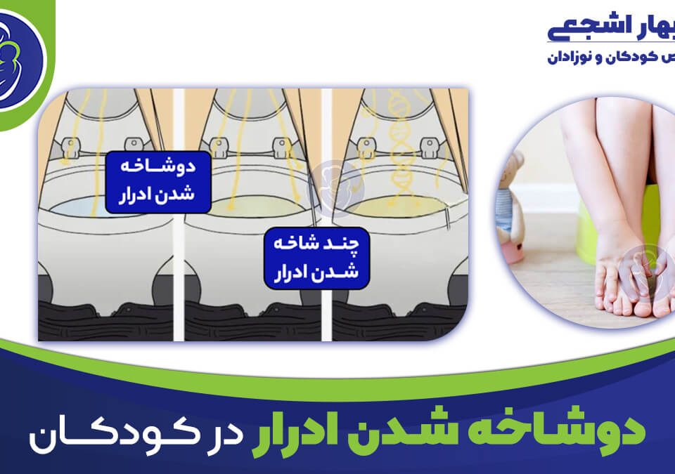 دوشاخه شدن ادرار در کودکان
