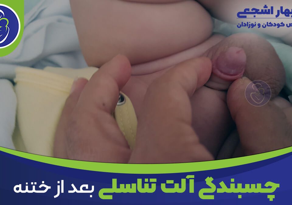 چسبندگی آلت تناسلی بعد از ختنه
