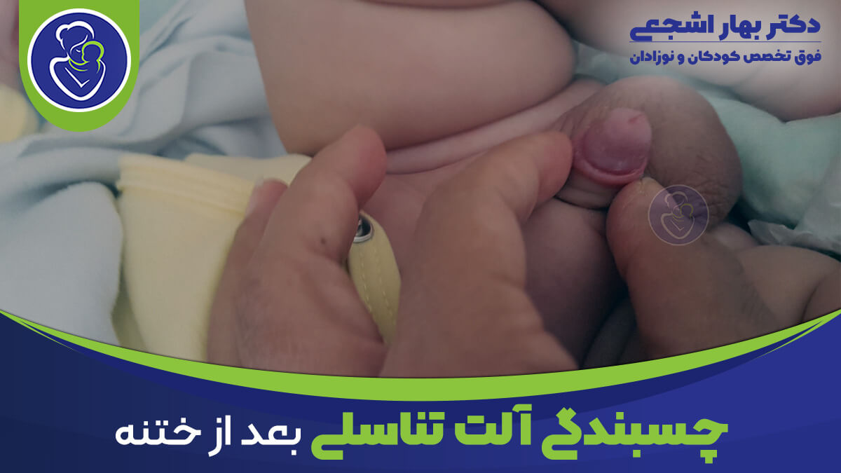 چسبندگی آلت تناسلی بعد از ختنه