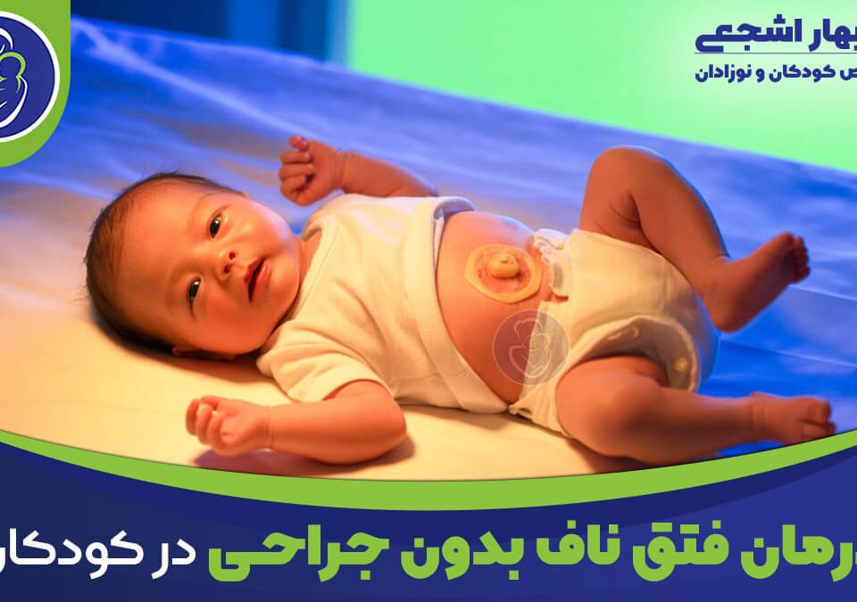 درمان فتق ناف در کودکان بدون جراحی