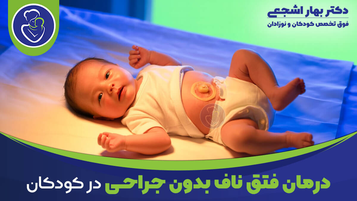 درمان فتق ناف در کودکان بدون جراحی